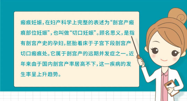 懷孕13周發(fā)現(xiàn)瘢痕妊娠！安琪兒婦科團(tuán)隊為她拆除身體里的這顆“定時炸彈”
