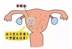 <b>子宮內(nèi)膜薄會(huì)影響懷孕嗎？</b>