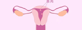 備孕必讀丨久備不孕，千萬別忽視求子路上的這個(gè)“攔路虎”！
